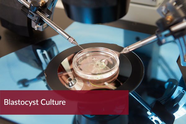 A Promising Procedure To Cure Infertility : Blastocyst Culture