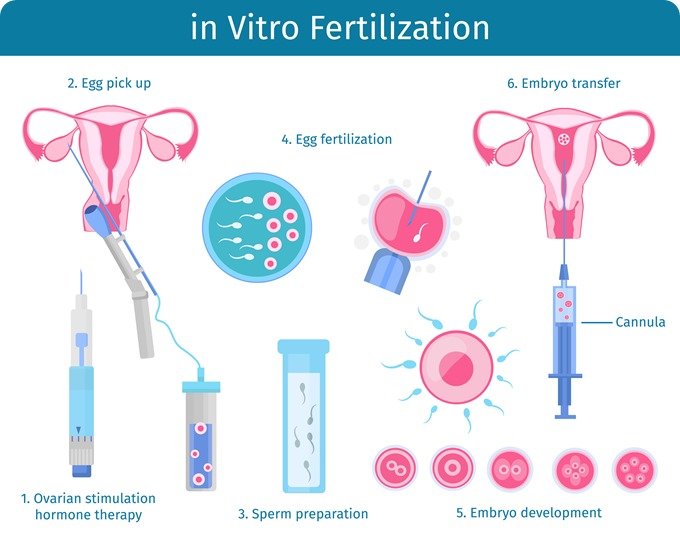 Can’t conceive!! Get the Best IVF Treatment From Genesis Fertility Center